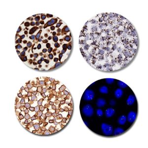 MDA-MB-231 FFPE Cell Pellet