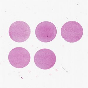 Breast Cancer Cell Pellet Array CPA01-01