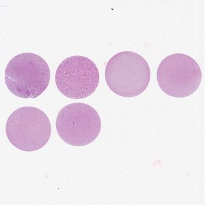 Colorectal Cancer Cell Pellet Array CPA05-01