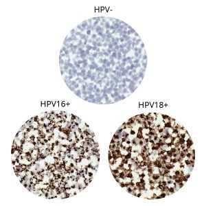 HPV Control Array (3 core)
