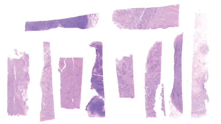 High RNA Quality FFPE Human Tissues – Acepix Biosciences