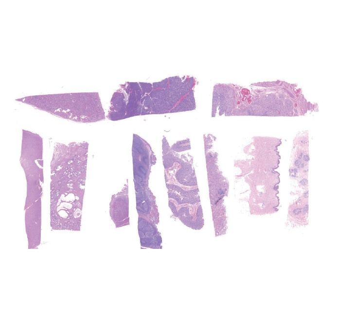 FFPE Human Normal Tissue Array