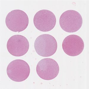 Lung Cancer Cell Pellet Array CPA02-01