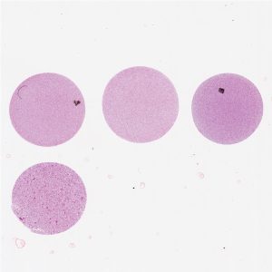 Prostate Cancer Cell Pellet Array CPA04-01